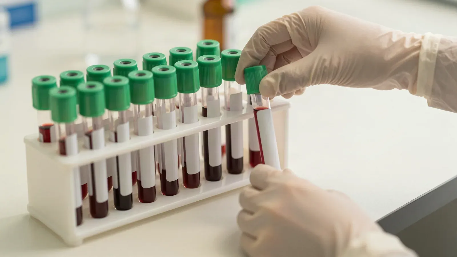 Tubos de coleta de sangue numa estante sobre bancada de laboratório